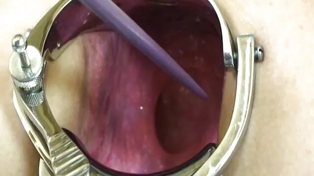 ماساژ عمیق گربه بسیار ضروری است فیلم سکسی زنان زیبا